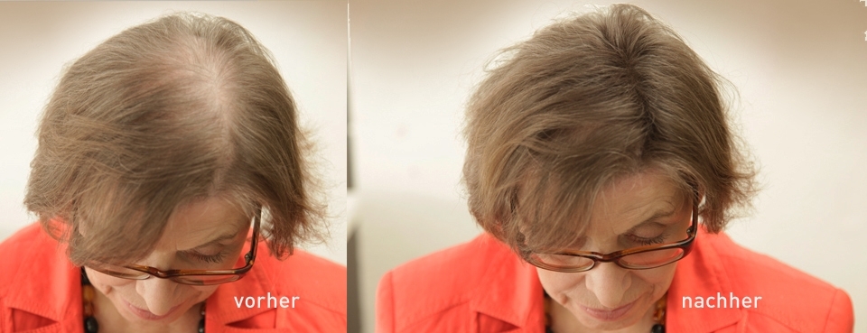 Dünnes und lichtes Haar bei Frauen Cover Hair hilft sofort